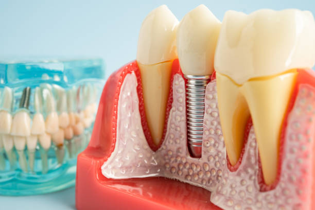 Professional Dental Services in St James, MD